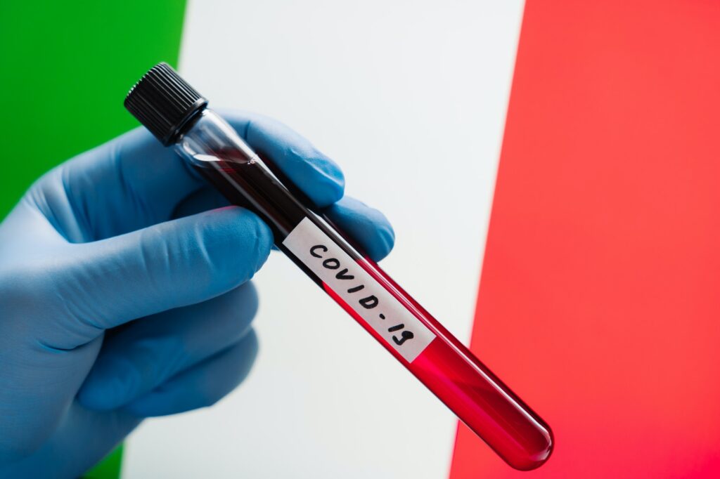 Coronavirus outbreak in Italy. Test blood sample in hand wearing medical gloves against Italian flag